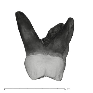 UW101-867 Homo naledi URM2 distal