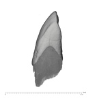 UW101-886 Homo naledi LRC mesial