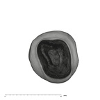 UW101-887 Homo naledi LLP4 apical