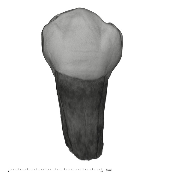 UW101-887 Homo naledi LLP4 buccal