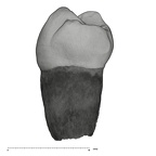 UW101-887 Homo naledi LLP4 distal
