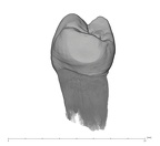 UW101-889 Homo naledi LLP3 distal
