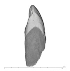 UW101-985 Homo naledi LLC mesial