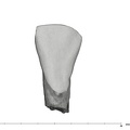 UW101-998 Homo naledi LLI2 crown labial