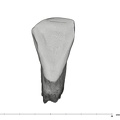 UW101-998 Homo naledi LLI2 crown lingual