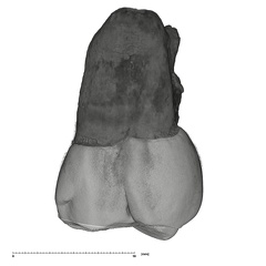UW101-999 Homo naledi URM1 lingual