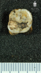 STW 141 Australopithecus africanus LLM1 occlusal