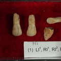 STW 151 Homo associated upper anterior dentiton 