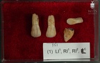 STW 151 Homo associated upper anterior dentiton 