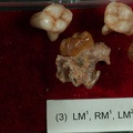 STW 151 Homo associated upper molars tray 3 1