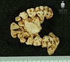 STW 151 Homo maxilla inferior