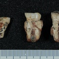 STW 19 Australopithecus africanus associated upper dentition buccal