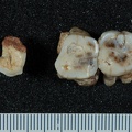 STW 19 Australopithecus africanus associated upper dentition occlusal