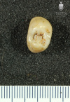 STW 202 Australopithecus africanus URP3 occlusal