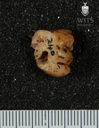 STW 246 Australopithecus africanus LLM1 buccal
