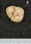 STW 252h Australopithecus africanus URM3 occlusal
