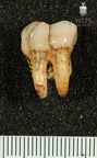 STW 252j Australopithecus africanus ULM1 buccal