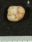 STW 252k Australopithecus africanus ULM2 occlusal