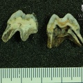 STW 284 Australopithecus africanus ULM2 fragments