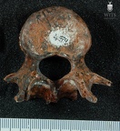 STW 431 Australopithecus africanus vertebra 9