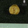STW 449 Australopithecus africanus URM3 occlusal
