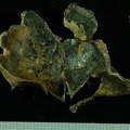 STW 53a Homo cranium medial