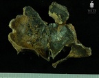 STW 53a Homo cranium medial