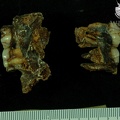 STW_53b_Australopithecus_habilis_partial_maxilla_associated_upper_dentition_medial.JPG