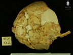 STW 53d Homo cranium