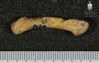 STW 63 Australopithecus africanus MC5L medial