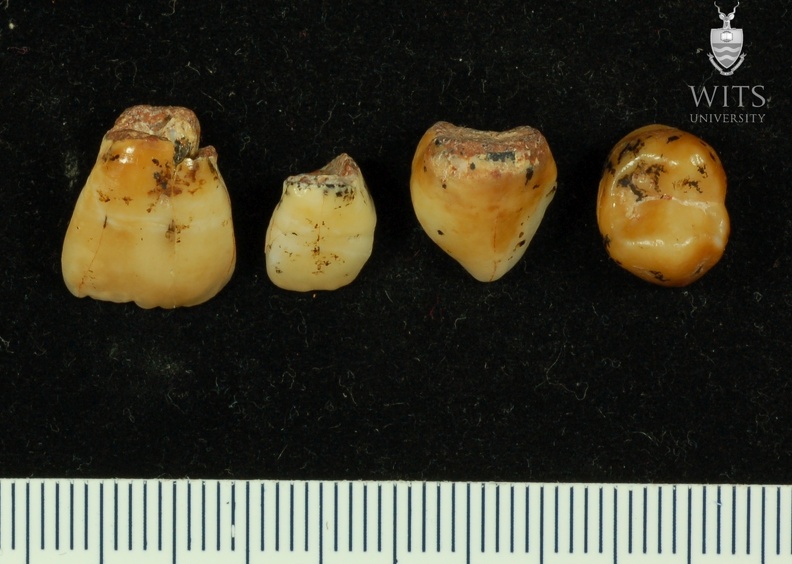 STW 75-79 Australopithecus africanus associated upper dentition 2