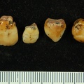 STW_75-79_Australopithecus_africanus_associated_upper_deciduous_dentition_2.JPG