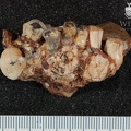 STW 80 Australopithecus africanus partial manbile superior 2