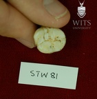 STW 81 Australopithecus africanus LRM3 occlusal