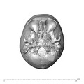 NGA88_SK752_Homo_sapiens_cranium_inferior.jpg